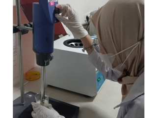 Mahasiswa Farmasi Unhas Kembangkan PZA-NLC-TSG, Inovasi Dukung Terapi TB Meningitis
